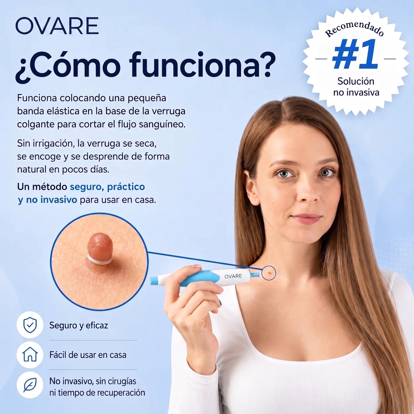 Kit removedor de verrugas
